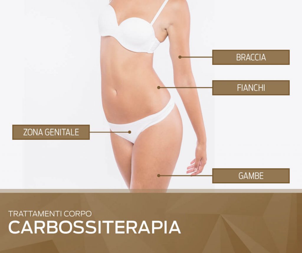 carbossiterapia