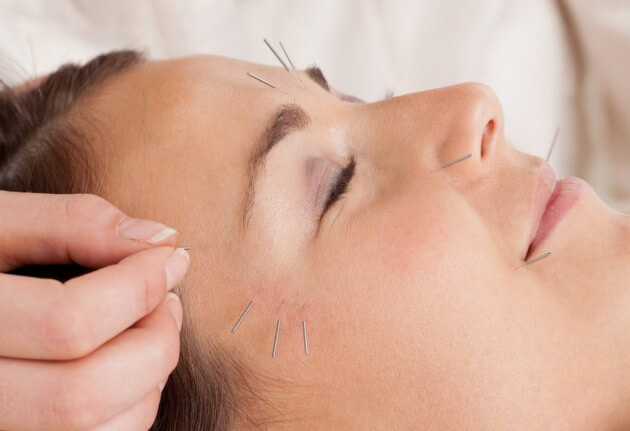 trattamento agopuntura estetica viso